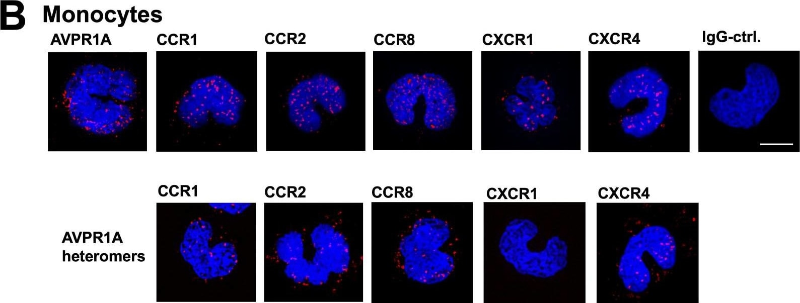 Detection of CCR1 by Immunocytochemistry/ Immunofluorescence