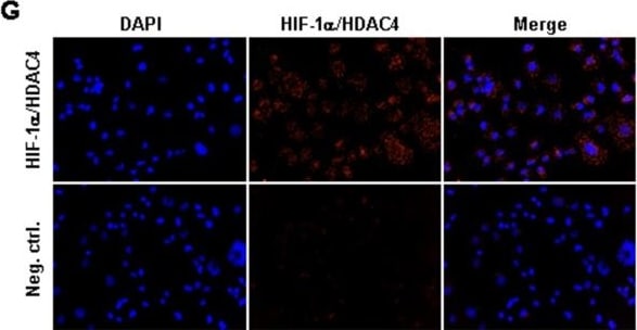 Detection of Human HIF-1 alpha by Immunocytochemistry/Immunofluorescence
