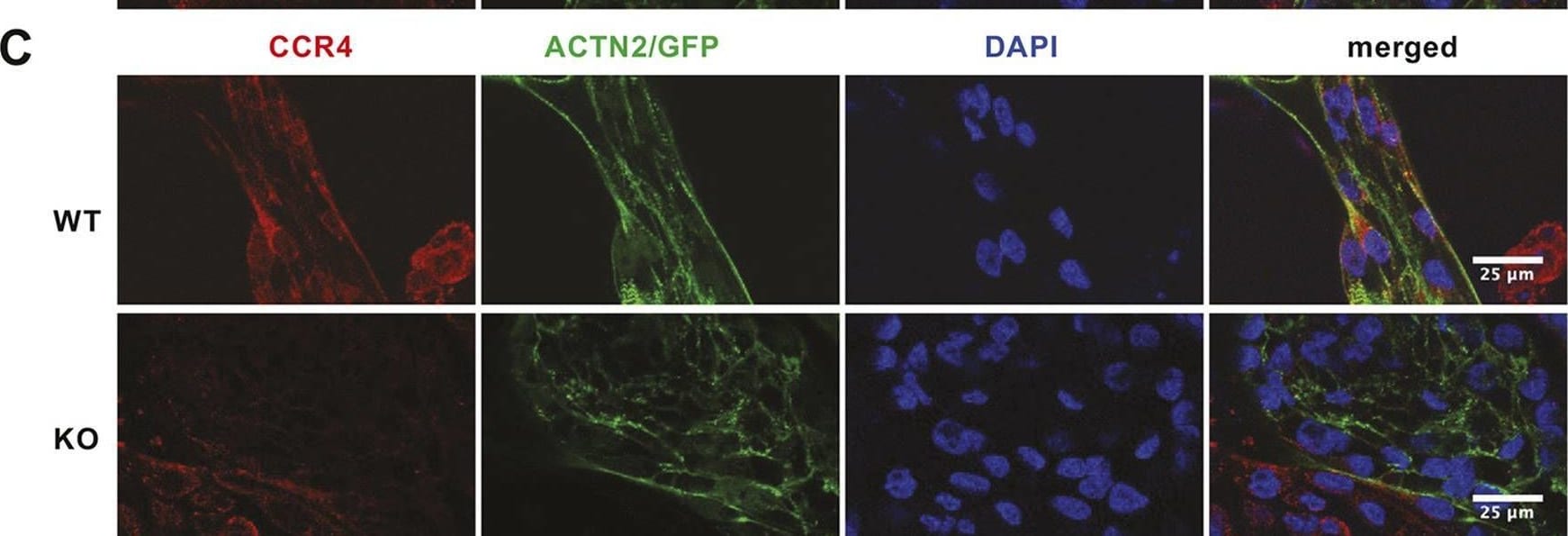 Detection of CCR4 by Immunocytochemistry/ Immunofluorescence