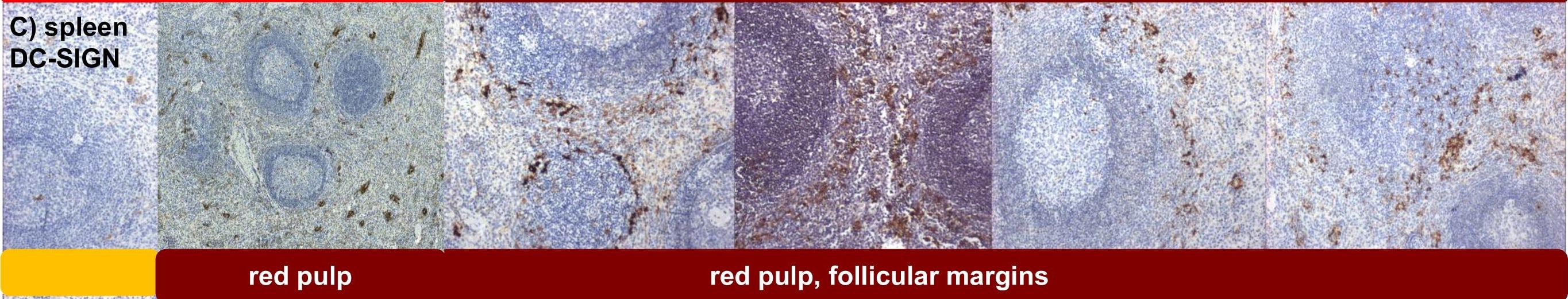Detection of Cynomolgus Monkey DC-SIGN/CD209 by Immunohistochemistry