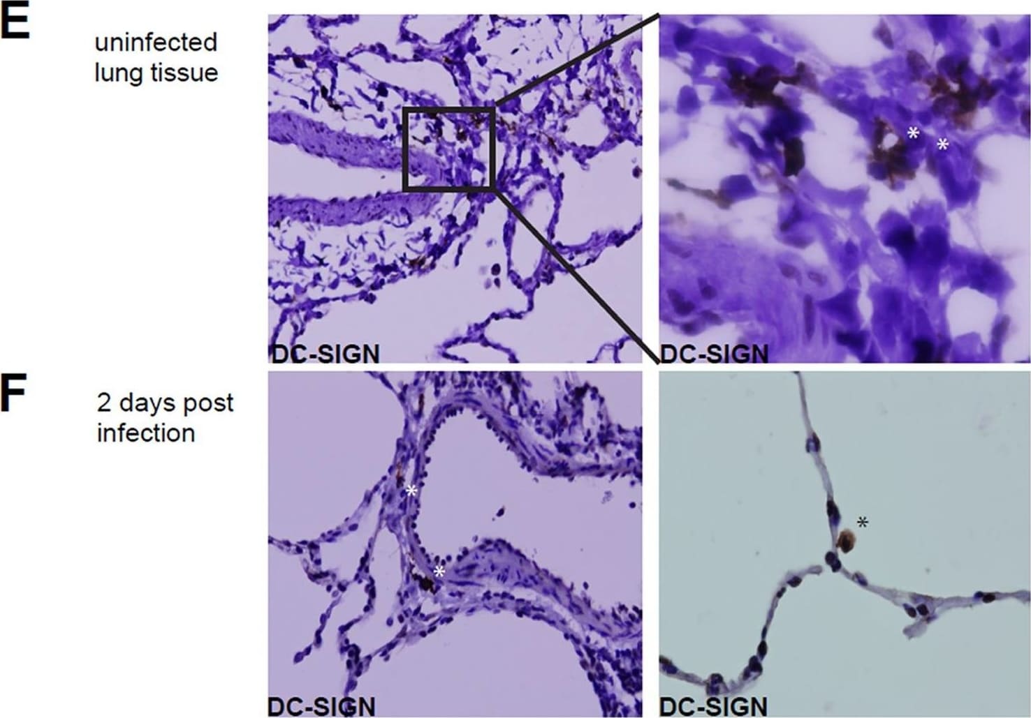 Detection of DC-SIGN/CD209 by Immunohistochemistry