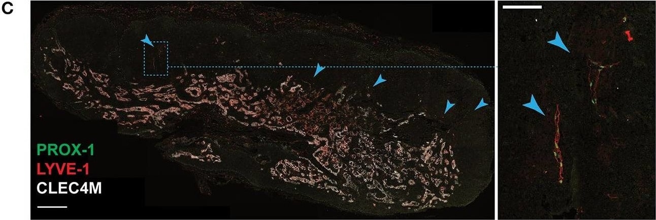 Detection of Human DC-SIGNR/CD299/CLEC4M by Immunocytochemistry/Immunofluorescence