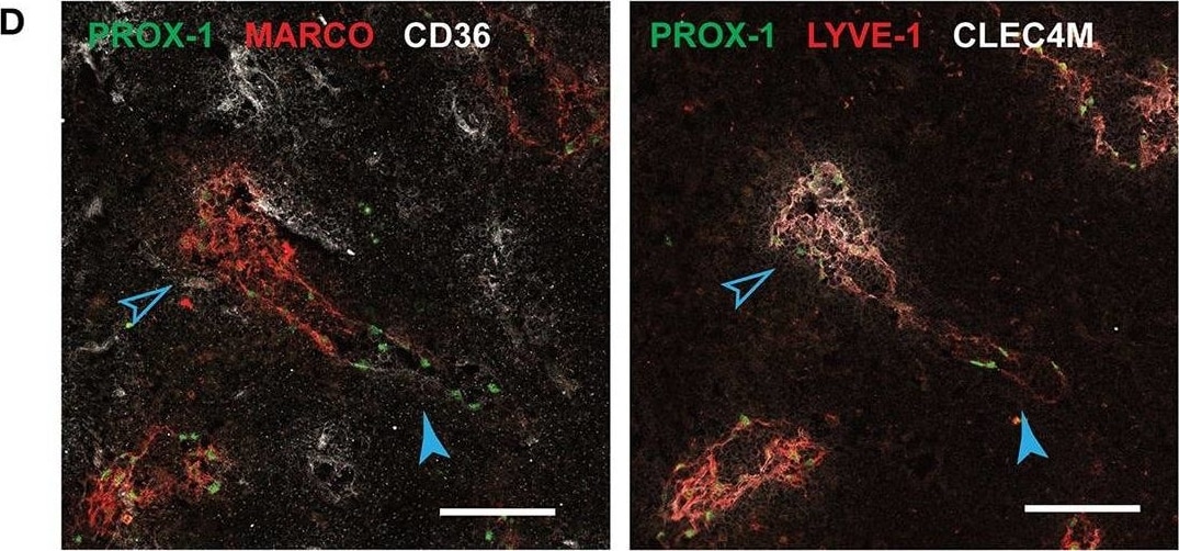 Detection of Human DC-SIGNR/CD299/CLEC4M by Immunocytochemistry/Immunofluorescence