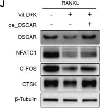 Detection of OSCAR by Western Blot