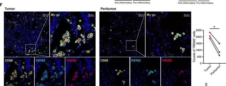 Detection of TREM2 by Immunohistochemistry