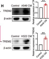 Detection of TREM2 by Western Blot