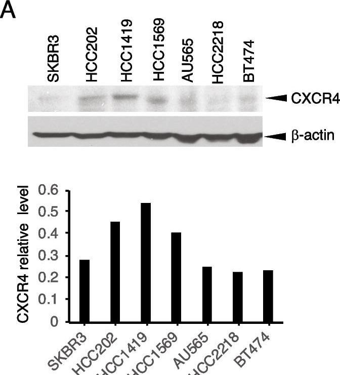 Detection of CXCR4 by Western Blot