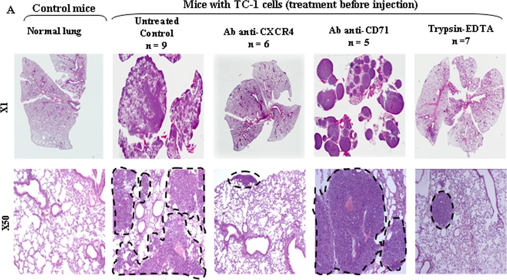 Detection of CXCR4 by Immunohistochemistry