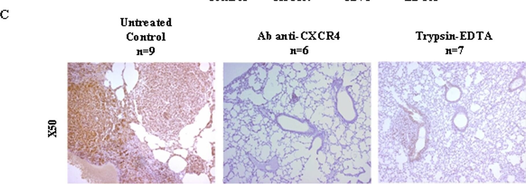 Detection of CXCR4 by Immunohistochemistry
