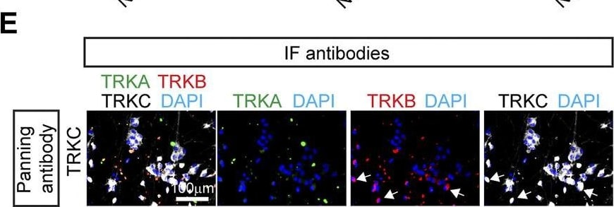 Detection of TrkA by Immunohistochemistry
