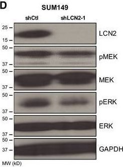 Detection of Lipocalin-2/NGAL by Western Blot