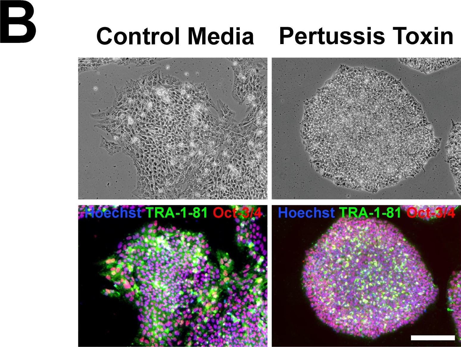 Detection of Human Oct-3/4 by Immunocytochemistry/Immunofluorescence