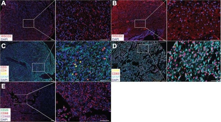 Detection of CD83 by Immunohistochemistry
