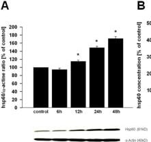 Detection of Human HSP60 by Western Blot