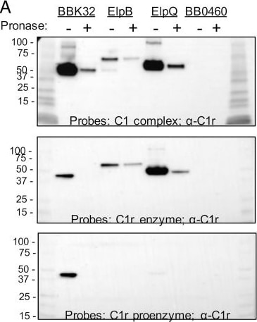 Detection of Complement Component C1r by Western Blot