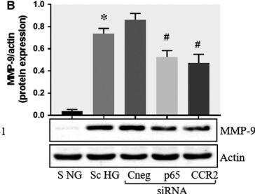 Detection of CCR5 by Western Blot