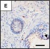 Detection of Human CCR5 by Immunohistochemistry