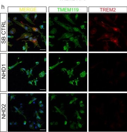 Detection of TREM2 by Immunocytochemistry/ Immunofluorescence