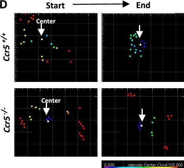 Detection of CCR5 by Immunocytochemistry/ Immunofluorescence