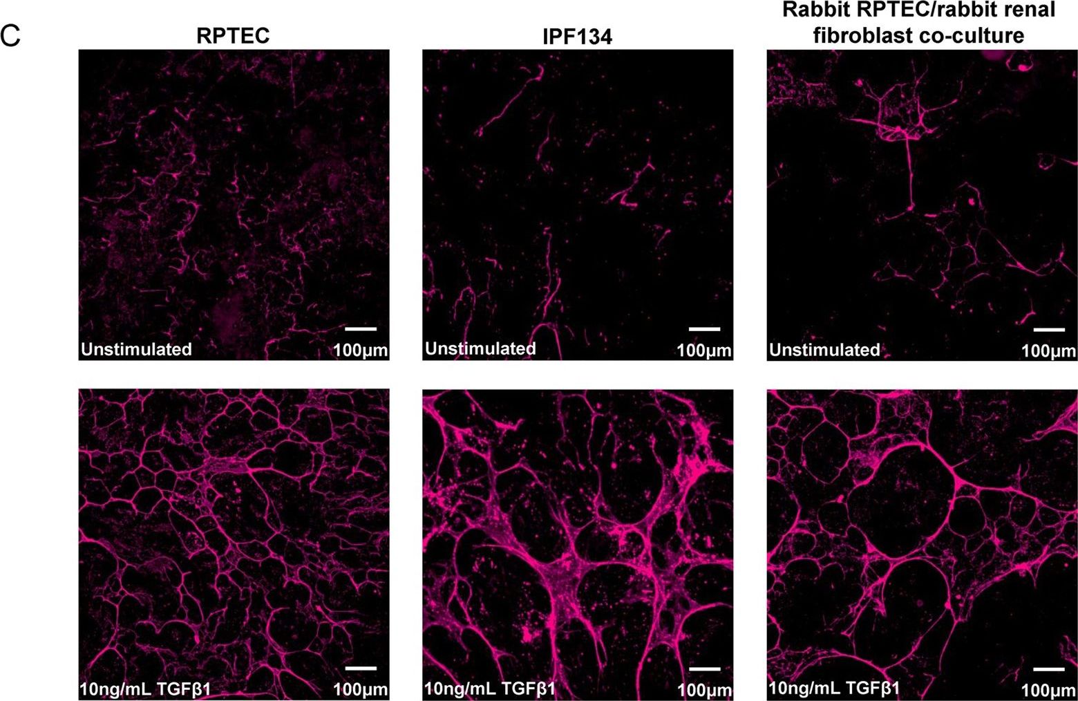 Detection of Human TGF beta 1/2/3 by Immunocytochemistry/Immunofluorescence