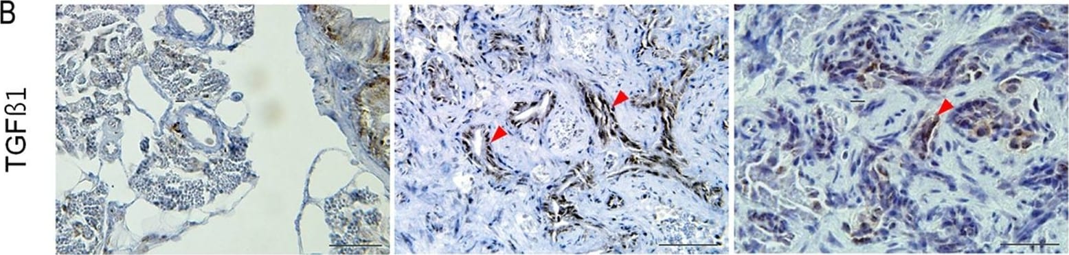 Detection of Zebrafish TGF beta 1/2/3 by Immunohistochemistry