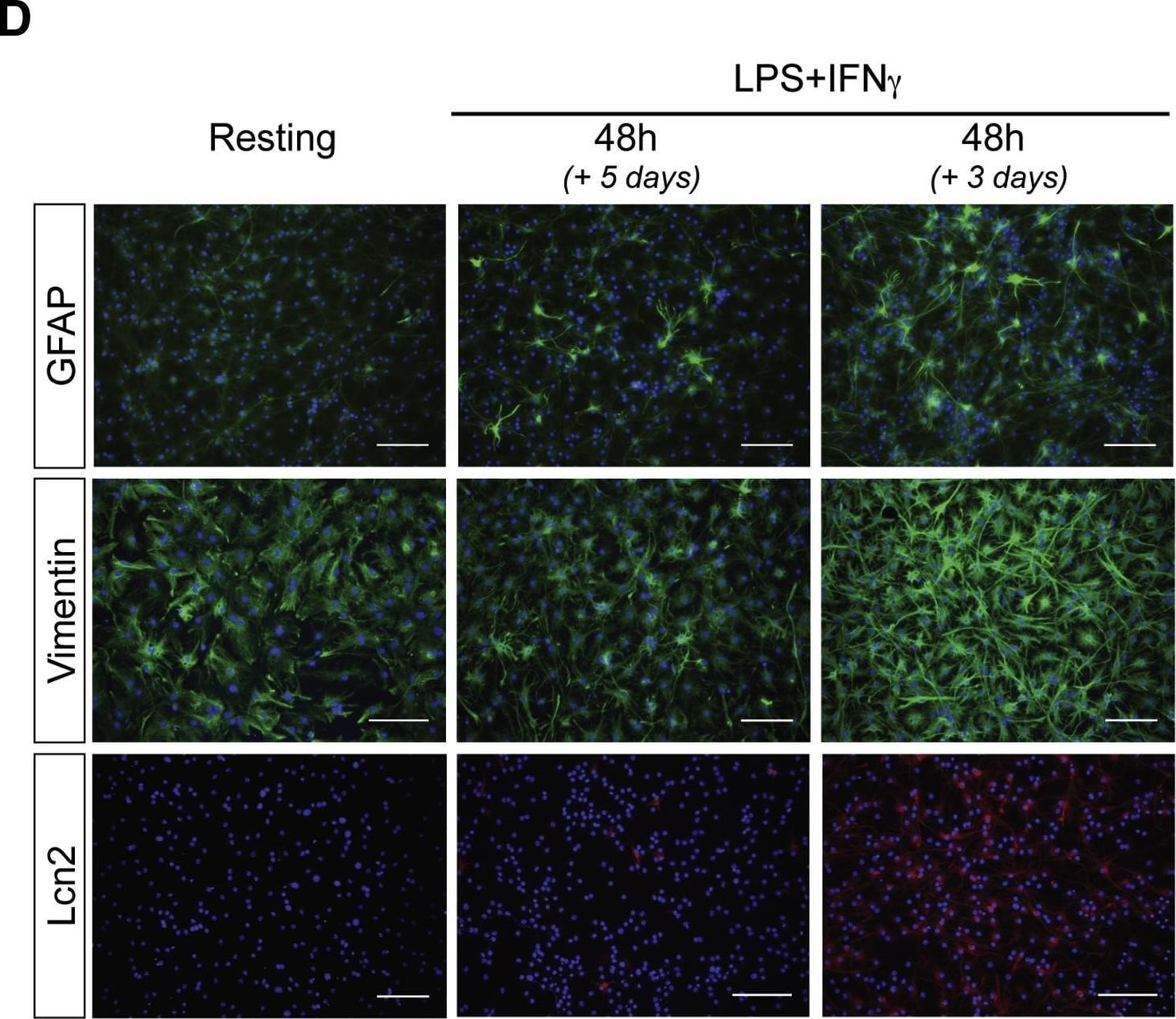 Detection of Lipocalin-2/NGAL by Immunocytochemistry/ Immunofluorescence