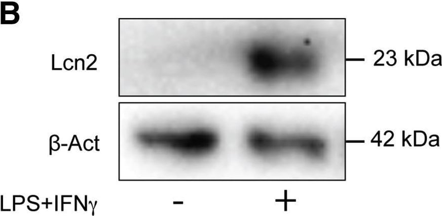 Detection of Lipocalin-2/NGAL by Western Blot