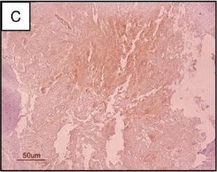 Detection of Human SCGF/CLEC11a by Immunohistochemistry