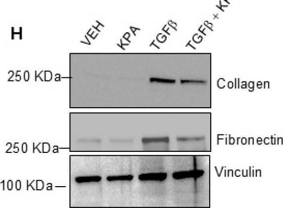 Detection of Fibronectin by Western Blot
