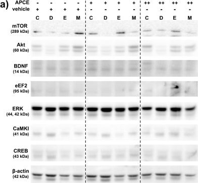Detection of ERK1 by Western Blot