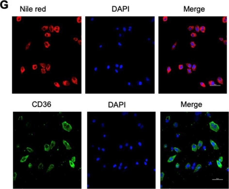 Detection of CD36/SR-B3 by Immunocytochemistry/ Immunofluorescence