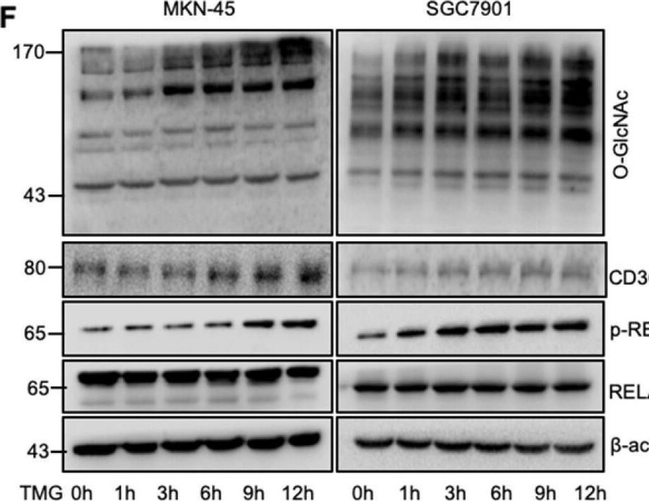 Detection of CD36/SR-B3 by Western Blot
