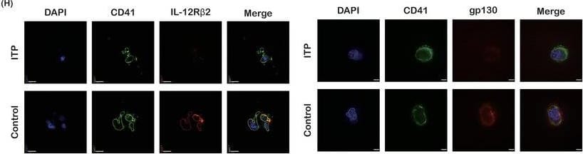 Detection of Human IL-12 R beta 2 by Immunocytochemistry/ Immunofluorescence