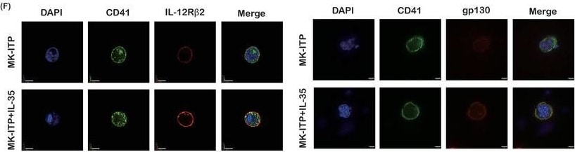 Detection of Human IL-12 R beta 2 by Immunocytochemistry/ Immunofluorescence