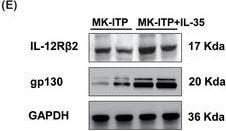 Detection of Human IL-12 R beta 2 by Western Blot