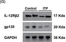 Detection of Human IL-12 R beta 2 by Western Blot
