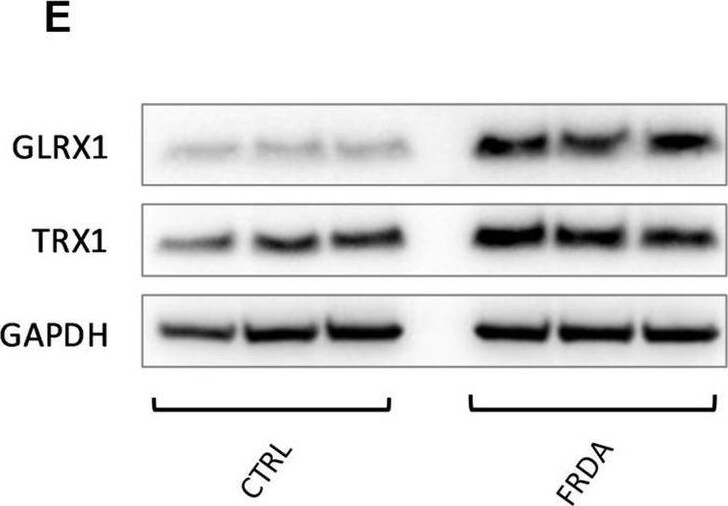 Detection of Thioredoxin-1 by Western Blot