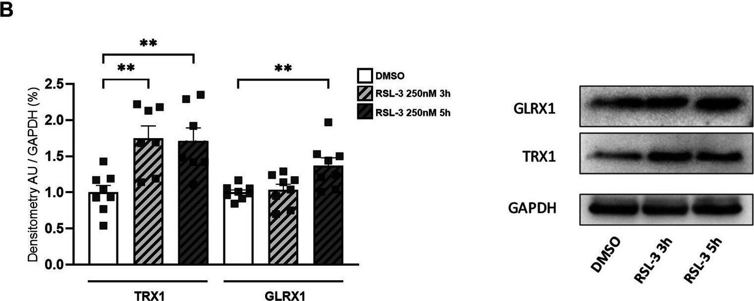 Detection of Thioredoxin-1 by Western Blot
