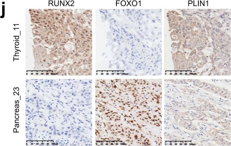 Detection of Human RUNX2/CBFA1 by Immunohistochemistry