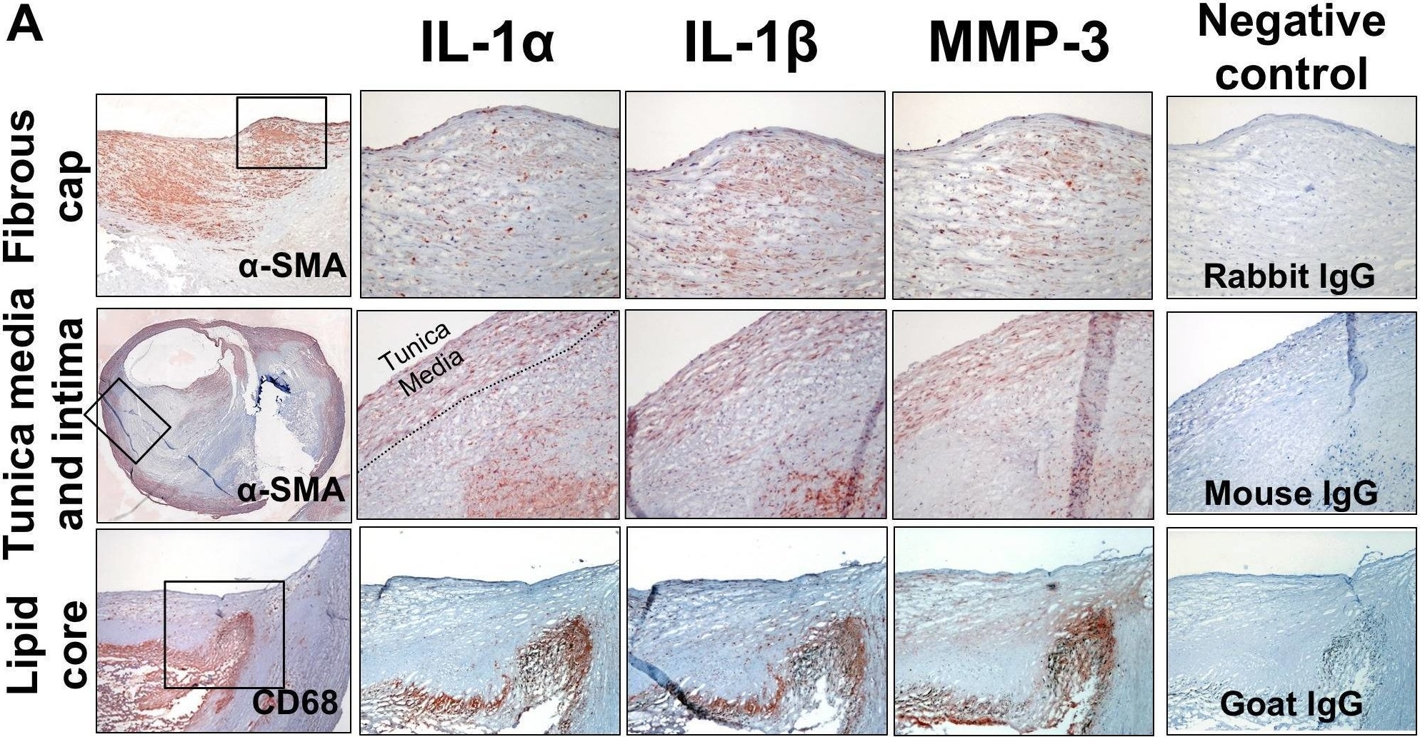 Detection of IL-1 alpha /IL-1F1 by Immunohistochemistry