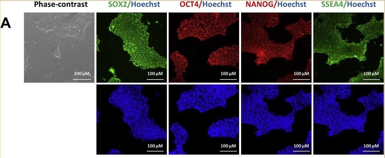 Detection of Human Human/Mouse/Rat SOX2 Antibody by Immunocytochemistry/ Immunofluorescence