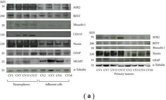Detection of Human SOX2 by Western Blot