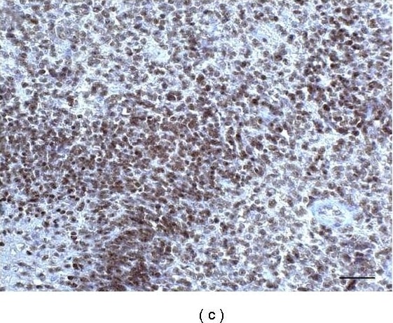 Detection of Human SOX2 by Immunocytochemistry/Immunofluorescence