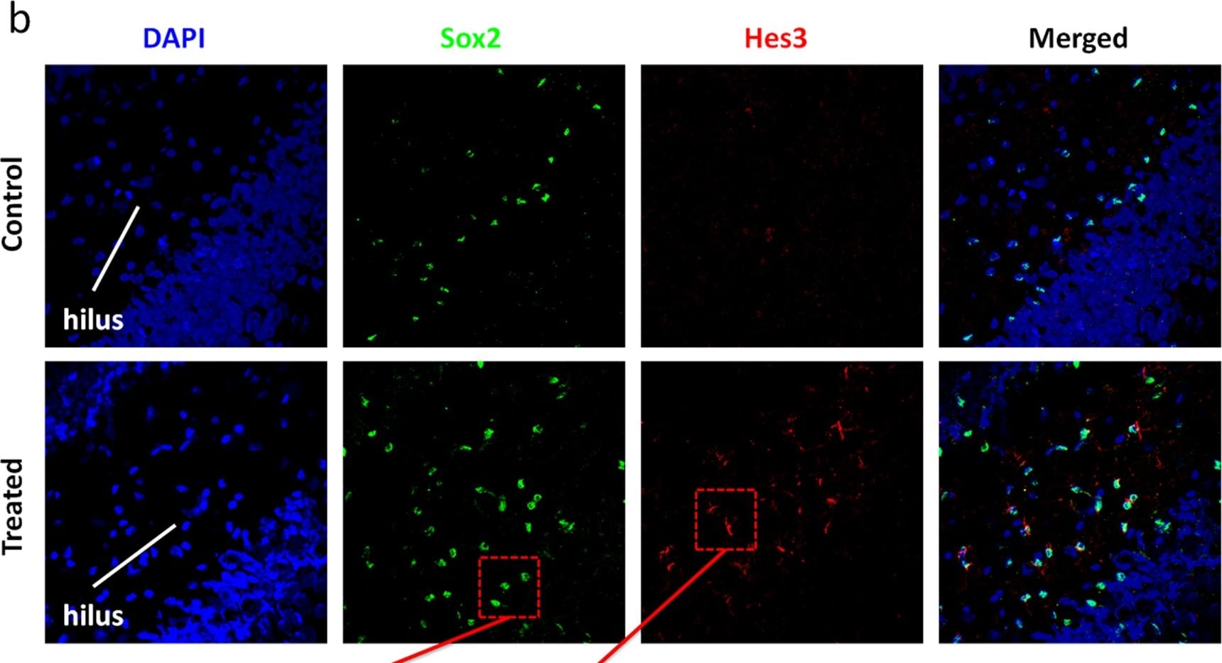 Detection of Rat SOX2 by Immunocytochemistry/Immunofluorescence