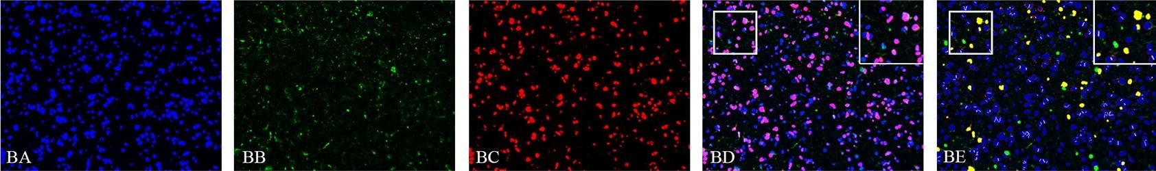 Detection of Human SOX2 by Immunocytochemistry/Immunofluorescence