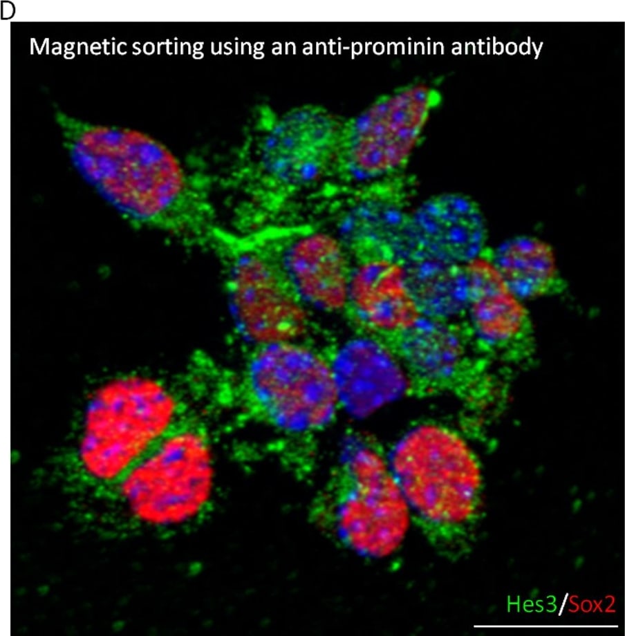 Detection of Human SOX2 by Immunocytochemistry/Immunofluorescence