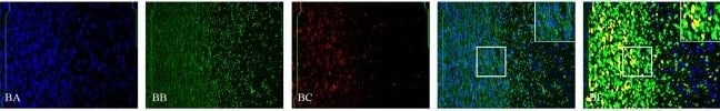 Detection of Human SOX2 by Immunocytochemistry/Immunofluorescence
