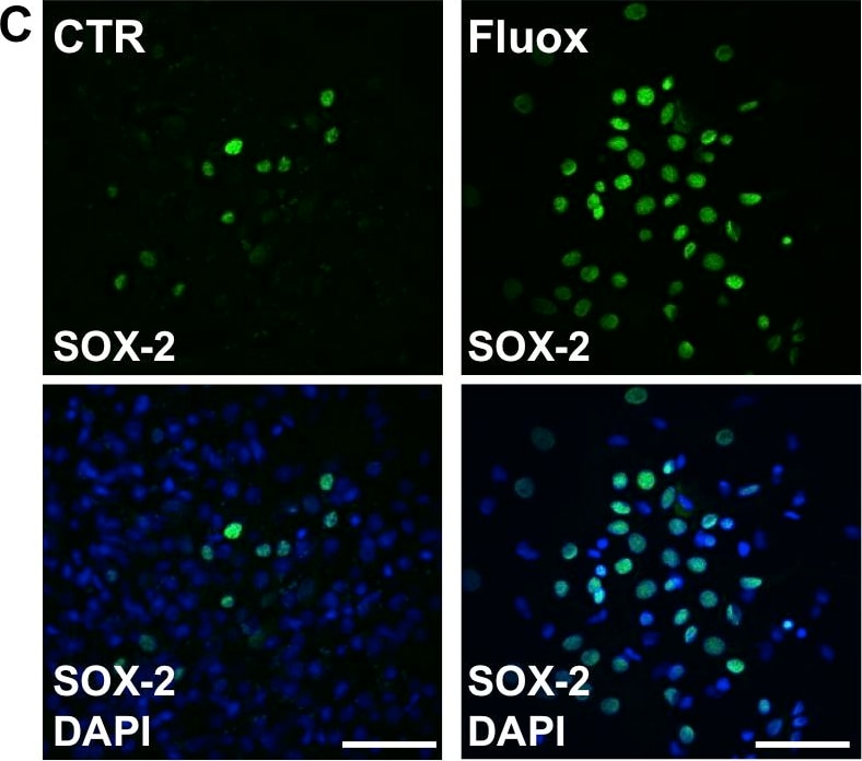 Detection of Rat SOX2 by Immunocytochemistry/Immunofluorescence