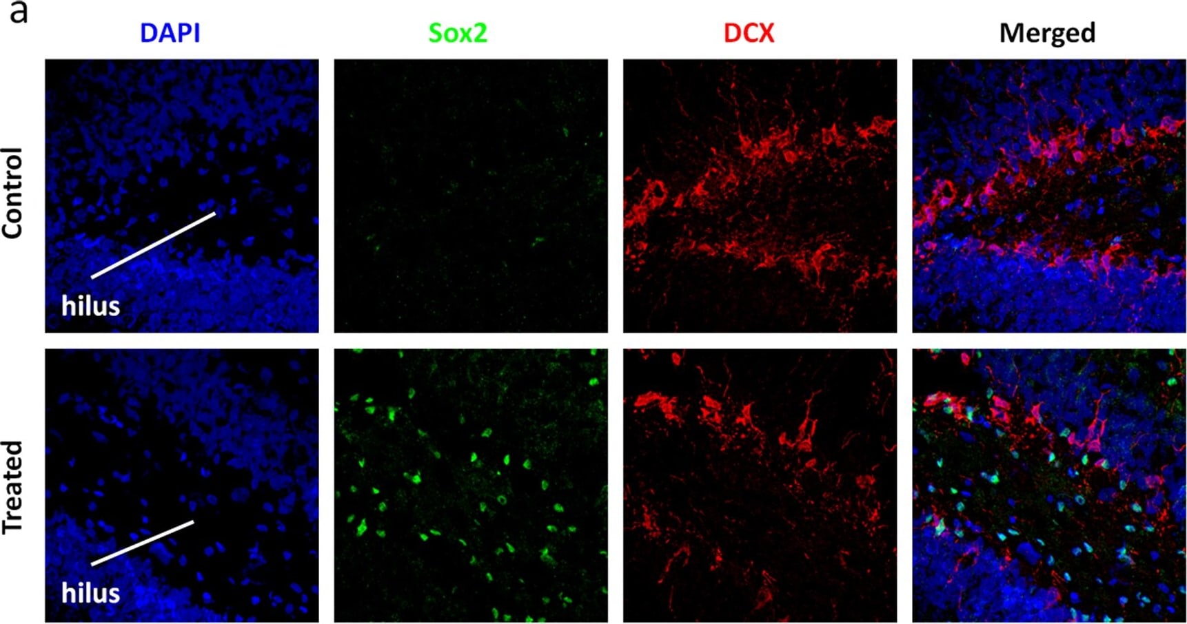 Detection of Rat SOX2 by Immunocytochemistry/Immunofluorescence