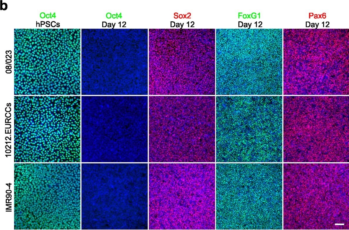 Detection of Human SOX2 by Immunocytochemistry/Immunofluorescence